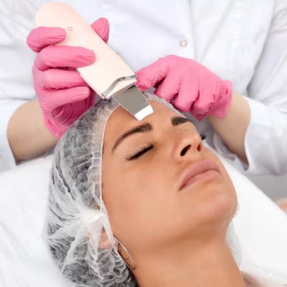 Peeling Ultrassônico Facial – Limpeza Profunda, Anticravos e Antirrugas