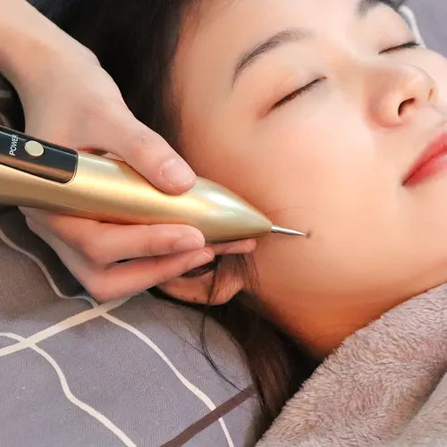 Caneta de Plasma LCD 9 Níveis – Remoção de Manchas