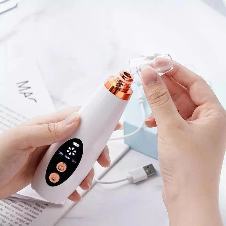 Removedor de Cravos USB Recarregável com Sucção – Limpeza Profunda Facial